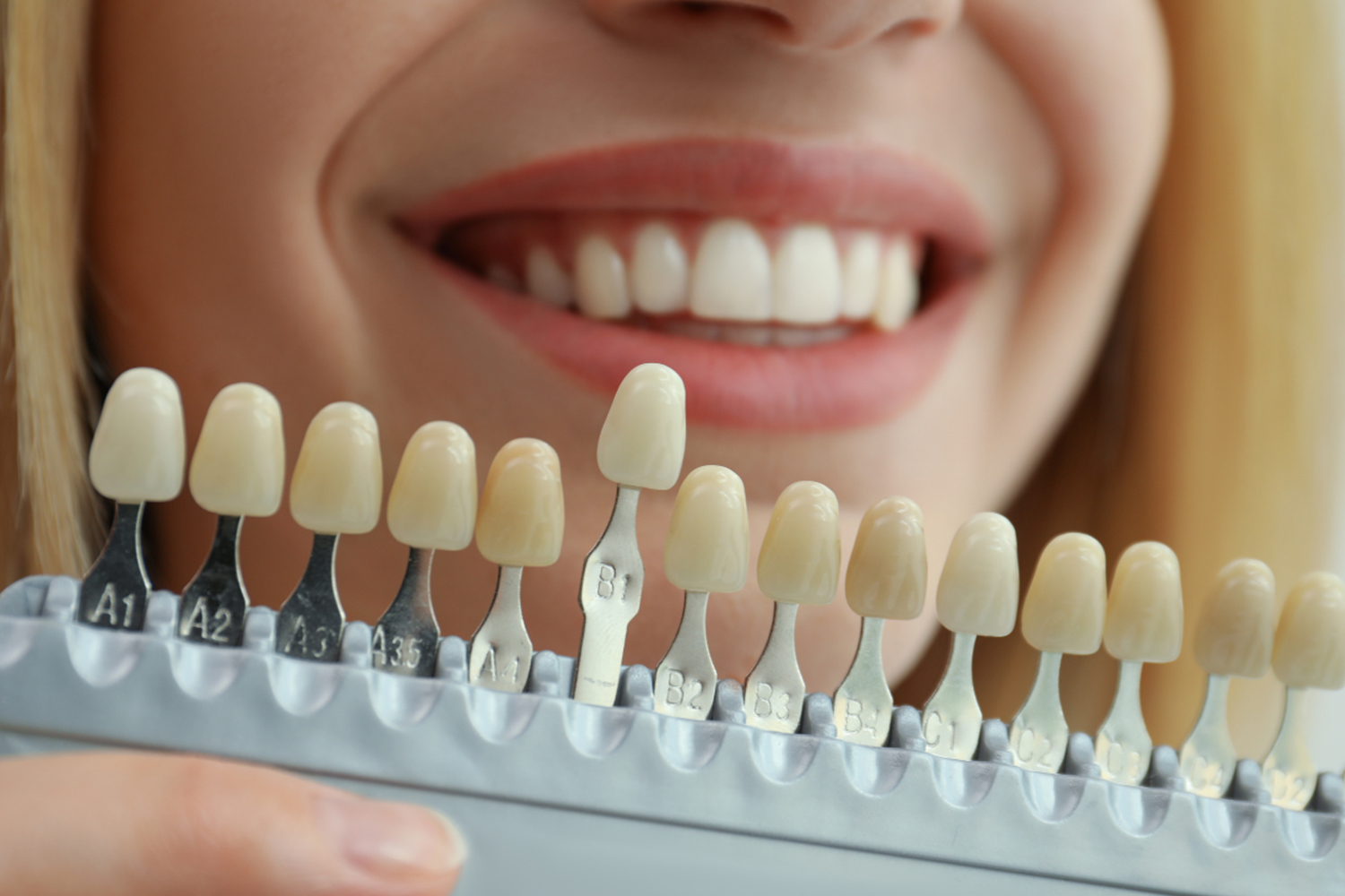 cosmetic dentist treatment planning consultation at Maplebrook Dental Uxbridge